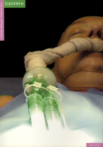 Lionel Bayol-Thémines - Update (+ DVD)