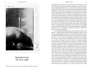 Ce que le sida m'a fait