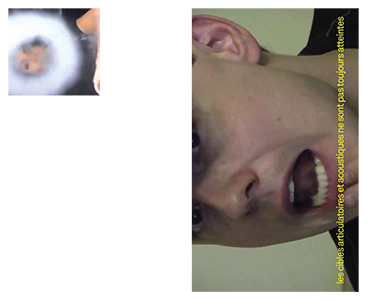 De la prise de parole sensible à la stratégie de communication médiatique en situation de crise